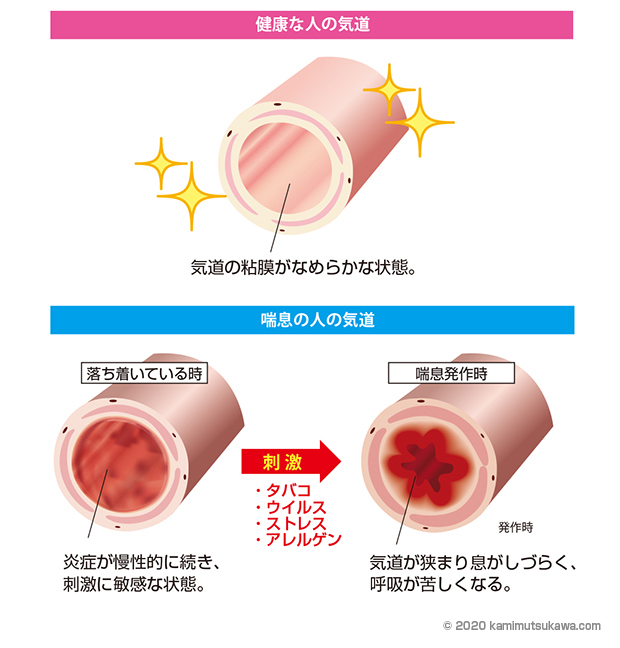 喘息の症状 検査 治療の基本情報 横浜弘明寺呼吸器内科クリニック健康情報局